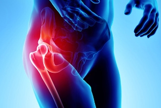 12 Common Hip Pain and Injuries in Athletes